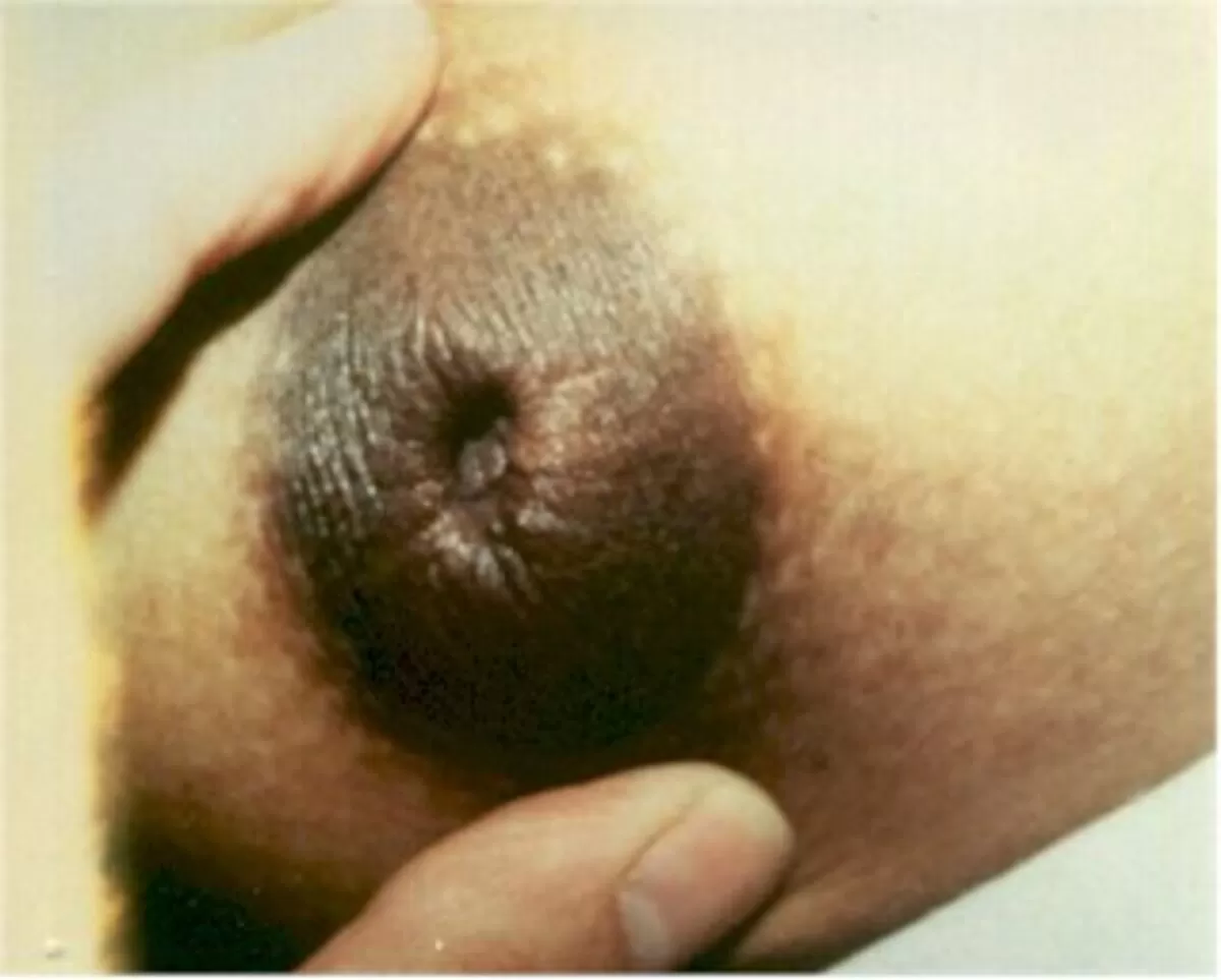 陥没乳首を掘り起こしたい!そんな欲求が湧き上がるおっぱい画像088