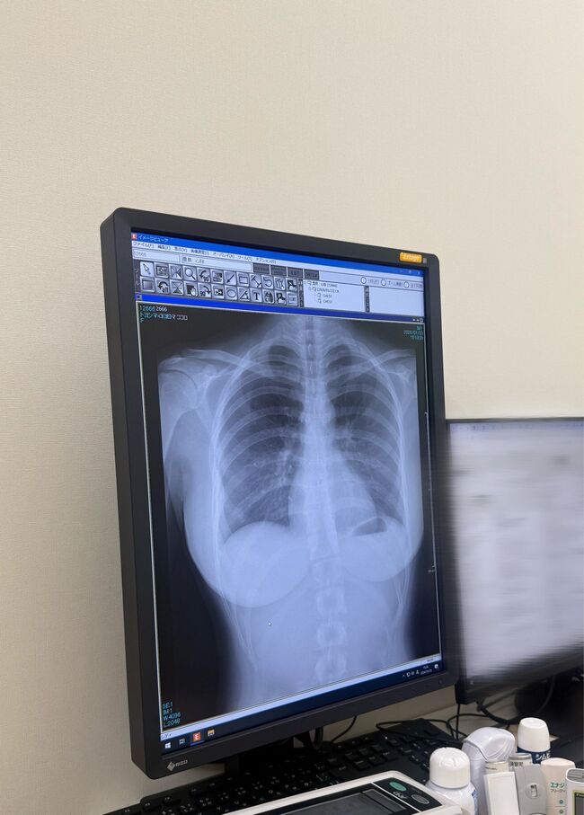 【画像4枚】豊島心桜がレントゲン写真で天然Iカップ巨乳を証明！001