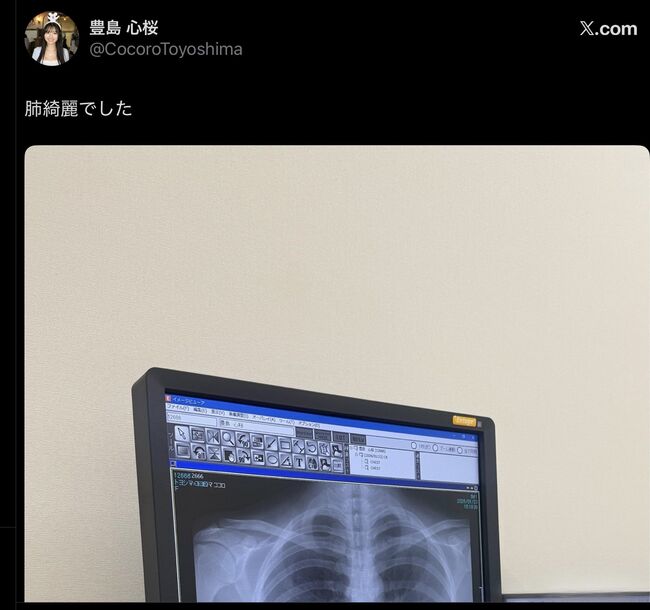 【画像4枚】豊島心桜がレントゲン写真で天然Iカップ巨乳を証明！002
