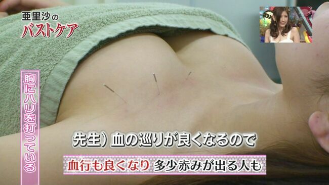 テレビエロ画像139枚 おっぱいポロリや胸チラ・パンチラまで芸能人のお宝ハプニング集めてみたのサムネイル